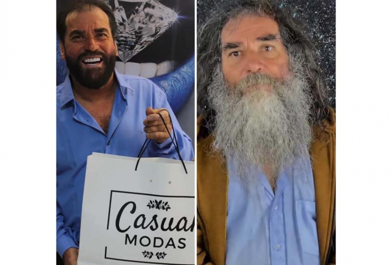 Dia de transformação: profissionais se unem para resgatar autoestima e renovar o sorriso de “Bodão” em Fartura 