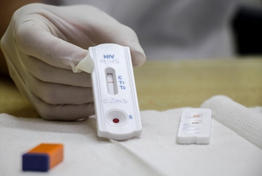 Postos de saúde de Avaré oferecem testes rápidos de HIV, sífilis e hepatites virais